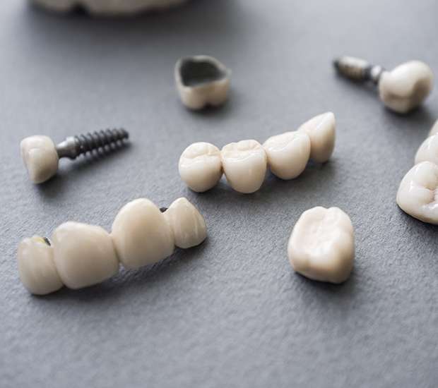 Shoreline The Difference Between Dental Implants and Mini Dental Implants